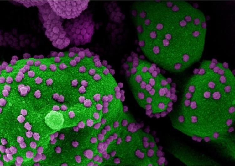 Vaccini, funziona nei topi lo spray nasale anti Covid